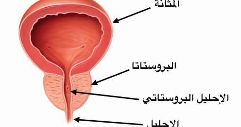 خلل في غدة البروستاتا