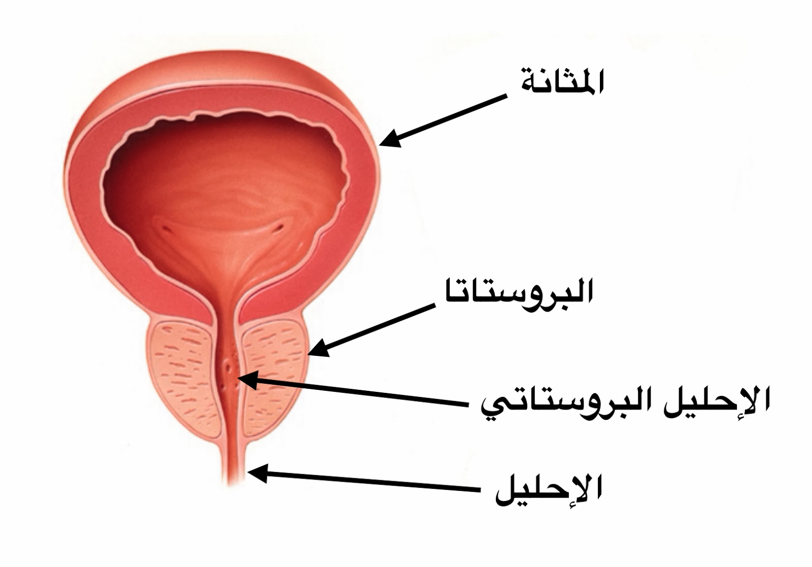 خلل في غدة البروستاتا