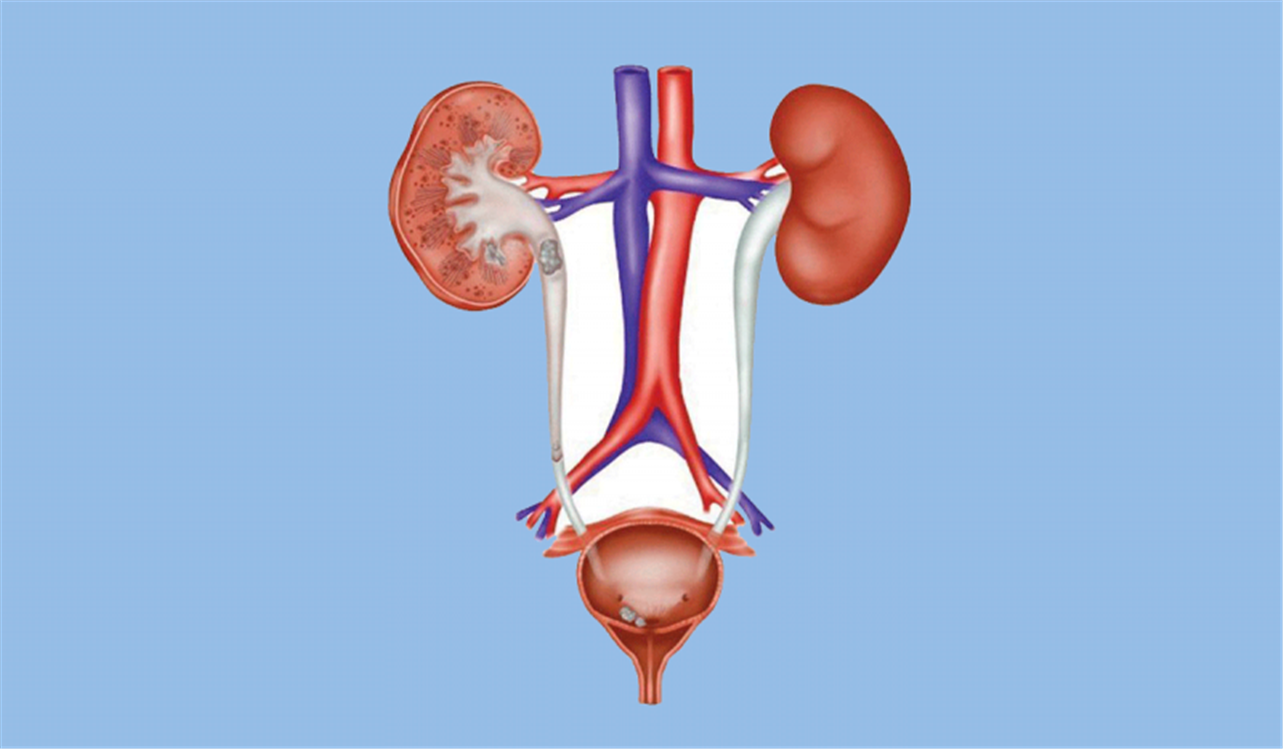 أعراض التهاب المسالك البولية (UTI)